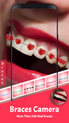 10 Best Remove Braces Apps For Android and iOS (Tutorial)